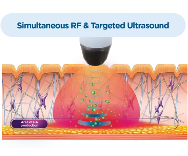 Pain Management Spring Grove IL Exion Ultrasound Pain Management Spring Grove IL Exion Ultrasound